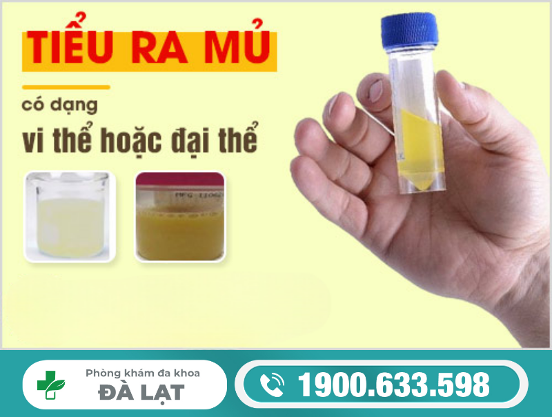 Hình ảnh minh họa